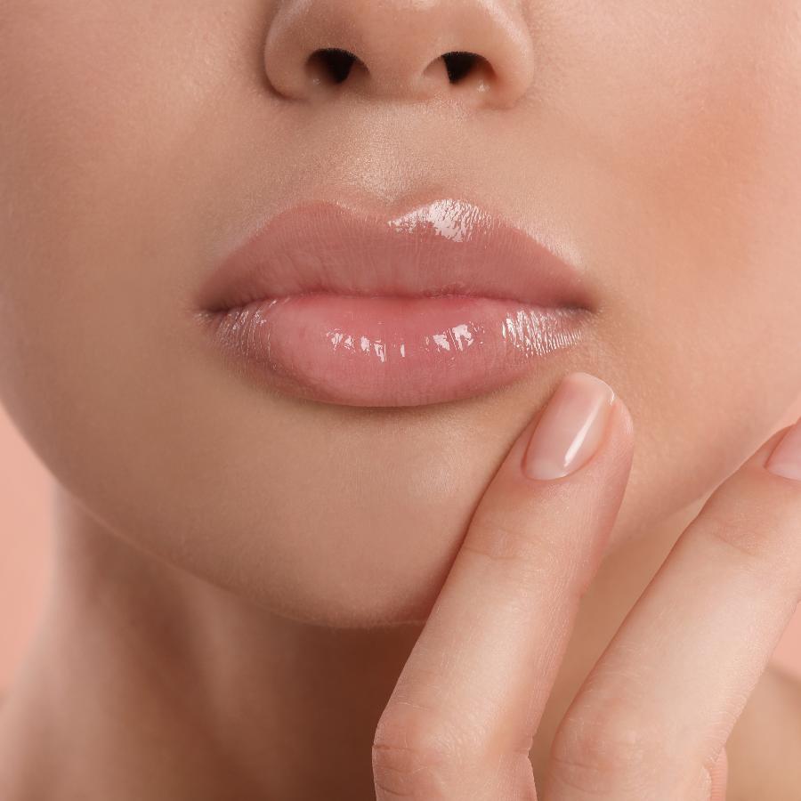 Aumento de labios ácido hialurónico